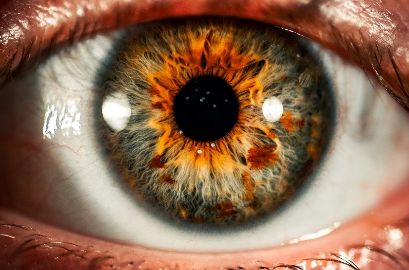iris
